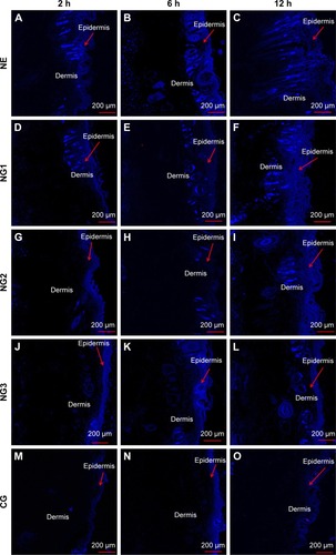 Figure 9 Visualization of drug traces in the abdominal skin of guinea pigs 2, 6, and 12 h after application of NE, NGs, and CG.Notes: NG1, NG2, NG3: NE gels containing 1%, 2%, and 3% (w/w) Carbopol® 934, respectively. (A–C) The trace of drugs in skin layers treated with NE, (D–F) NG1, (G–I) NG2, (J–L) NG3, and (M–O) CG at time intervals 2, 6 and 12 h, respectively.Abbreviations: CG, conventional gel; NE, nanoemulsion; NG, NE gel.