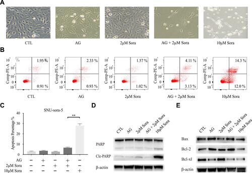 Figure 4 Sub-toxic AG-1024 combined with sorafenib has less impact on apoptosis. (A) Morphological images of SNU-sora-5 taken with an inverted microscope (x100) after various treatments for 72h. (B and C) Apoptosis assay of SNU-sora-5 after different treatments for 72h. (D and E) Western blot analysis of apoptosis-related proteins, PARP, Cle-PARP, Bax, Bcl-2 and Bcl-xl in SNU-sora-5. Data are shown as mean ± SD. Student’s t-test was used for two-group comparisons. **P <0.01.