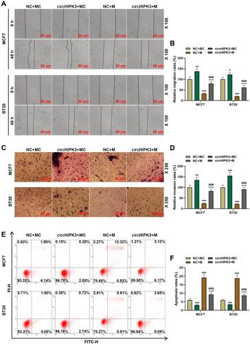 Figure 5 Overexpression of miR-326 partially offset the effect of circHIPK3 on cell migration, invasion and apoptosis of breast cancer (BCa). (A and B) Cell migration in NC + MC, circHIPK3+ MC, NC + M, and circHIPK3 +M groups was determined by the wound-healing assay (magnification × 100). (C and D) The number of cell invasion in each group was detected by Transwell (magnification × 250). (E and F) Flow cytometry was performed to detect cell apoptosis in each group at 48 h MCF7 and BT20 cells transfected with circHIPK3 and miR-326 alone or combined. Each experiment was repeated three times independently. *P < 0.05, **P < 0.01, ***P < 0.001 vs NC + MC; ^^^P < 0.001 vs circHIPK3 + MC; ###P < 0.001 vs NC + M.