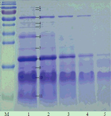 Figure 2. One-dimensional electrophoretogram of isopropanol extracts at different isopropanol concentrations. Lane M, 170 kD protein marker (from top to bottom: 170, 130, 100, 70, 55, 40, 35, 25, 15 and 10 kD); Lanes 1–5, extracts with 35%, 40%, 45%, 50% and 55% isopropanol, respectively. Note: 15% resolving gel; no ultrasonic treatment.