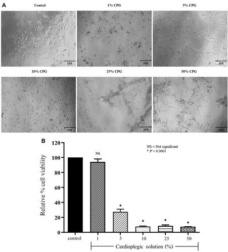 Figure 4 Optimization of cardioplegic solution concentration in primary porcine cardiomyocytes. The cells were cultured in various cardioplegic solution concentrations, consisting of 1–50% for 24 hours. (A) The change of cell morphology was captured under microscopy (10X). (B) The percentage of cell viability was examined by MTT assay (n=3). Each bar graph represents the mean±SD. One-way ANOVA analyzed data with Tukey’s Multiple Comparison Test, NS = not significant, *p<0.0001 compared to control.