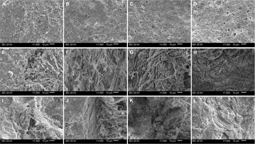 Figure 3 SEM micrographs of UFICPC0 (A–D), UFICPC3 (E–H), and UFICPC7 (I–L) before and after immersion in lipase PBS: before immersion (A, E, I), after immersion for 1 day (B, F, J), 3 days (C, G, K), and 7 days (D, H, L).Notes: No apparent degradation was observed from the UFICPC0 specimens besides surface microporosity (A–D). The PCL fibers became thinner with time and a lot of fibers had completely disappeared on day 7, leaving many fiber traces (grooves) in the CPC matrix (E–L). Bar: 10 μm.Abbreviations: CPC, calcium phosphate cement; PBS, phosphate buffer solution; PCL, poly(ε-caprolactone); SEM, scanning electron microscope; UFICPC, ultrafine fiber-incorporated CPC.