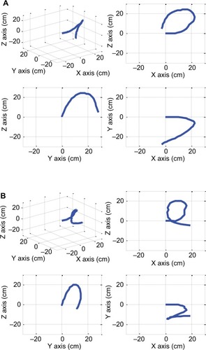 Figure 18 The original voltage equation produces an incomplete curve (A). The modified voltage equation completes the curve giving a more accurate representation (B).