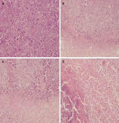 Figure 5. Pathology section of tumor with different PTX formulation. Normal saline as a control (A), Taxol® (B), plain liposome (C) and pH-sensitive liposome (D). (hematoxylin and eosin,original magnification ×200).