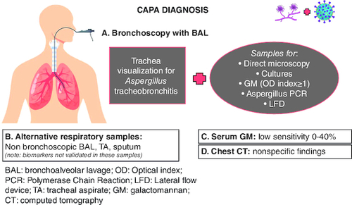 Figure 2. COVID-19-associated aspergillosis diagnosis.CAPA diagnosis is challenging, as non-immunocompromised critically ill patients lack the classical host risk factors. Bronchoscopy with BAL is the most reliable diagnostic tool to obtain lower respiratory tract samples for direct microscopy, cultures, PCR, GM, LFD and discriminate colonization from invasive pulmonary aspergillosis (IPA). Imaging findings of IPA may overlap with those of COVID-19 pneumonia and typical signs, such as the halo and air crescent sign, are not commonly seen in CAPA.
