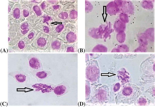 Figure 2. Some chromosomal aberrations induced by exposure to different concentrations of urea in the meristematic tissues of Allium cepa L.: (a) laggard chromosome; (b, c) sticky chromosomes; (d) C-mitosis.