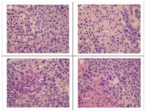 Figure 8 Tumor slices stained with hematoxylin and eosin. The slices were prepared from the margin of xenografts, and the necrotic area in the FA-M(PTX) group is significantly increased compared with that of the other groups. Straight arrows: tissue necrosis; curved arrows: macrophages; swallowtail arrows: lymphocytes. (A) Control, (B) PTX (C) M(PTX), and (D) FA-M(PTX).Abbreviations: PTX, paclitaxel; M(PTX), paclitaxel-loaded micelles; FA-M(PTX), folate-targeted, paclitaxel-loaded micelles.