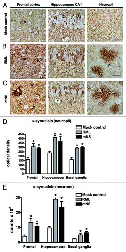 Figure 2. Infectious prions promote increased α-synuclein immunoreactivity. (A) α-synuclein aggregates typically deposit within neurons (labeled “n”), shown here in the frontal cortex and hippocampus, and in the neuropil (granular staining) as seen in the mock control. (B) RML prion infection. (C) mNS prion infection. In prion-infected mice, α-synuclein aggregates were more abundant in neurons and in the neuropil (cortex), and additionally appear as scattered plaque-like structures (labeled pl). Vacuoles due to the prion disease are also evident (labeled v). Scale bar = 20 µm. Computer aided image analysis for the levels of α-synuclein immunoreactivity in the neuropil of the frontal cortex, hippocampus and basal ganglia expressed as corrected optical density. (D) Stereological (dissector method) analysis of the estimated numbers of α-synuclein positive neurons in the frontal cortex, hippocampus and basal ganglia expressed as total counts x 102. *p < 0.05 by one way ANOVA with post hoc Dunnet's when comparing to mock control, n = 5 per group.