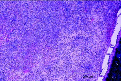 Figure 3. Well-demarcated granulomatous nodule attached to the cartilage of the tracheal wall (hematoxylin and eosin staining, bar = 500 μm).