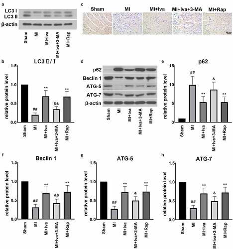 Figure 4. Effect of ivabradine on autophagy function of MI rats. (a) Representative Western blot (WB) bands of LC3II/I. (b) Quantification of LC3II, as normalized to LC3I. (c) Representative immunohistochemistry (IHC) staining images of ATG-5. (d) Representative WB bands of p62, Beclin1, ATG-5 and ATG-7. Quantification of p62 (e), Beclin1 (f), ATG-5 (g) and ATG-7 (h), as normalized to β-actin. n = 6 hearts/group. Data were expressed as mean ± SD; ##P < 0.01 vs Sham group; **P < 0.01 vs MI group; &P < 0.05, &&P < 0.01 vs MI+Iva group. Abbreviations: 3-MA, 3-methyladenine; Iva, ivabradine; MI, myocardial infarction; Rap, rapamycin