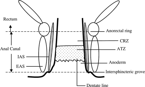 Figure 1.  Schematic anatomy of the anal canal. IAS, internal anal sphincter. EAS, external anal sphincter. CRZ, colo-rectal zone. ATZ, anal transitional zone.