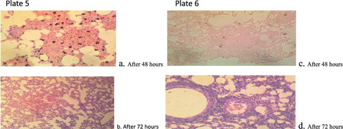 Figure 5. Plate 5(a and b): P. citrinum (2.3 × 107): There are multiple foci of necrosis and accumulation of necrotic debris. Embedded within the debris are clear unstained fungal hyphae. There are multiple foci of alveolar macrophages laden with dense aggregates of black pigments. Plate 6(c and d): P. citrinum (3.2 × 105):There are multiple foci of necrosis and accumulation of necrotic debris. There are extensive foci of alveolar macrophages laden with mild aggregates of black pigment (Mg: 100×).