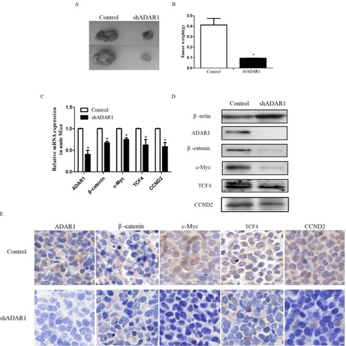 Figure 4 Silence the ADAR1 inhibits AML proliferation and Wnt pathway in vivo. (A) The effects of ADAR1 knockdown on cell proliferation in K562 cells in vivo. (B) Summarized data of the tumor weight. (C) The effect of ADAR1 knockdown on the expressions of Wnt effectors measured by qPCR in vivo. (D) The effect of ADAR1 knockdown on the expressions of Wnt effectors measured by Western Blot in vivo. (E) The effect of ADAR1 knockdown on the expressions of Wnt effectors measured by Immunohistochemical staining. All the above experiments were repeated at least three times. The data represents mean ± SD of three independent experiments. *P<0.05.