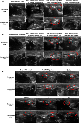 Figure 4 Ultrasonographic imaging of sciatic nerve in transverse and longitudinal view. (A) Ultrasonographic images after perineural injection of SonoVue and PVO nanoparticles at the normal sciatic nerve. The normal nerve exhibits enhancement beyond the area around the nerve where SonoVue has spread. (B) Ultrasonographic images using normal saline, SonoVue, and PVO nanoparticles targeting neuritis sites. SonoVue generates a clinically meaningless contrast pattern, while PVO nanoparticles exhibit a lesion-specific contrast effect. (C) Ultrasonographic images enhanced by PVO nanoparticles and follow-up images. It gradually fades and disappears at 3 h. The scale bar is 5 mm.