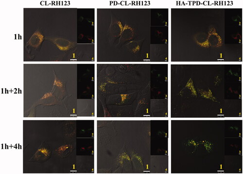 Figure 5. Confocal microscope images of MCF-7/MDR cells for intracellular delivery of HA-TPD-CL-RH123 for different time. The lysosomes were stained by Lyso-Tracker Red. 1: overlay of 1, 2 and 3; 2: green fluorescent of RH123-labeled liposomes; 3: red fluorescent of lysosomes; 4: bright field of cells; 1 h: incubation with liposomes for 1 h, followed by imaged by CLSM; 1 h + 2 h: incubation with liposomes for 1 h, followed by washing and further incubation for 2 h; 1 h + 4 h: incubation with liposomes for 1 h, followed by washing and further incubation for 4 h; Scale bar: 10 μm.