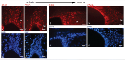 Figure 8. SOX2 and PPARγ in rostro-caudal regions of the LVs. A-D, rostral LV, dorsal neurogenic region immunostained for SOX2/DAPI (A-B) and PPARγ/DAPI(C-D). E-H, caudal LV. Dorso-lateral neurogenic region immunostained for SOX2/DAPI (E-F) and PPARγ/DAPI(G-M)Bar = 40 μm.