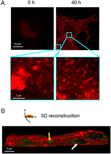 Figure 1. Overexpression of full length TDP-43 leads to nuclear depletion of endogenous TDP-43 and formation of TDP-43 cytoplasmic inclusions. (A) Representative STED microscopy images of NSC-34 cells (n = 3) transfected with 20 µg of pCI-neo plasmid expressing human TDP-43 and analyzed immediately after and 40 h after transfection. Red fluorescence: total TDP-43 (endogenous and exogenous). Higher magnifications show round (left) and elongated (right) TDP-43 inclusions. (B) 3D reconstruction of the z-stack analysis (5-μm-thick slices) of the specimens shown in (A). A NSC-34 cell was virtually dissected on the zy plane to show more clearly the intracellular TDP-43 inclusions. Red and green fluorescence: cell membrane (WGA) and exogenous (human) TDP-43, respectively. Yellow and white arrows: round and elongated inclusions, respectively.