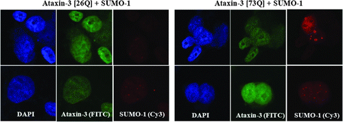 Figure 2.  Ataxin-3 and SUMO-1 are associated and co-localized mostly in nucleus. After transfection of HA-ataxin-3 ([26Q] or [73Q]) with FLAG-SUMO-1, cells were incubated 24 h and fixed/permeabilized. To observe the protein localization, cells were incubated with anti-HA antibody followed by FITC-anti-IgG antibody (ataxin-3) and anti-FLAG antibody followed by Cy3-anti-IgG antibody (SUMO-1). DAPI was used for nuclear staining. Small dot-like structures in SUMO-1 panel represent SUMO-1 recruited to nuclear bodies (see text).