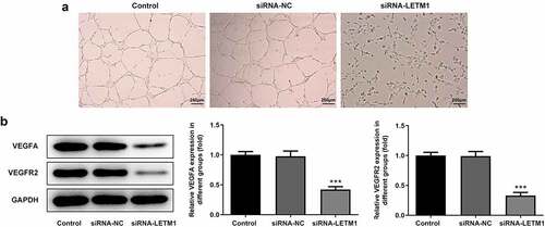 Figure 3. The results of angiogenesis in ESCC. (a) The pictures of tube formation; (b) The related protein expression of tube formation. ***P < 0.001 vs. siRNA-NC