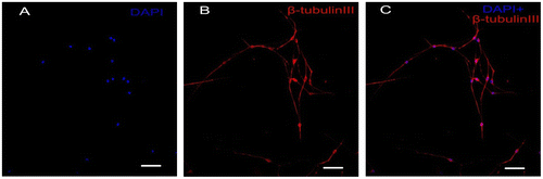 Fig. 1. Immunocytochemistry staining of cultured primary DRG neurons.Notes: The DRG neurons were stained with neuronal specific antibody β-tubulin III(B, red), the nucleus were stained with DAPI (A, blue), and the double label is shown in (C) Scale bar, 50 μm.