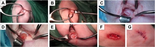 Figure 1 Surgical phases.