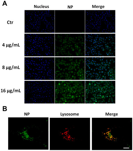 Figure 4 Cellular uptake and intracellular localization of HCINPs in MV3 cells. (A) Dose-dependent cellular uptake of HCINPs by MV3 cells measured using inverted fluorescence microscopy. (B) Colocalization images of HCINPs in MV3 cells by CLSM.