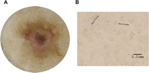 Fig. 2 (a) Three weeks old, F. sporotrichioides culture on PDA medium. (b) Conidia spores of F. sporotrichioides grown on PDA medium at 25°C for 3 weeks