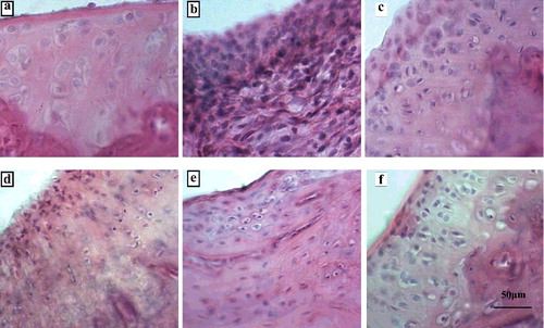 Figure 1. Histopathological observation of the ankle joint of adjuvant arthritis in rats ( ×400). Normal group (a); CFA model group (b); dexamethasone group (c); PTTF 3.5-mg/kg-dose group (d); PTTF 7-mg/kg-dose group (e); PTTF 14-mg/kg-dose group (f).