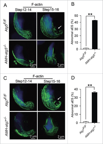 Figure 4. Apical ES assembly defect in autophagy-deficient mice. (Aand C) Apical ES assembly was perturbed in AMH-atg5−/−and AMH-atg7−/−spermatids attached with some Sertoli cell regions. (A) Super-resolution microscopy analysis of the F-actin structure by immunofluorescence of phalloidin (green, labeled by FITC) in the spermatids attached with Sertoli cell regions of Atg5Flox/Floxmice (upper panels) and AMH-atg5−/− mice (lower panels). (C) Super-resolution microscopy analysis of the apical ES of Atg7Flox/Floxmice (upper panels) and AMH-atg7−/− mice (lower panels). Nuclei were stained with DAPI (blue). Arrows indicated TBCs. (B and D) Disordered F-actin structures of apical ES significantly increased in the autophagy-deficient mice. (B) 42.87 ± 0.49% of apical ES with perturbed F-actin structures in AMH-atg5−/− mice (black column), whereas only 1.48 ± 0.23% disordered apical ES in the Atg5Flox/Flox mice (white column). (D) 36.14 ± 0.98% of disordered apical ES in the AMH-atg7−/− mice (black column), while only 1.35 ± 0.29% in the Atg7Flox/Flox mice (white column).