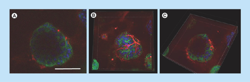 Figure 6.  MCF-12A and Hs 578Bst co-cultured cells form bilayered acini in Matrigel.(A–C) Confocal microscopy images of MCF-12A and Hs 578Bst cells forming a 3D bilayered acini when co-cultured in Matrigel. Acini were immunolabeled with an E-cadherin-specific antibody (green) and an smooth muscle actin-specific antibody (red). Nuclei are stained with 4′,6-diamidino-2-phenylindole (blue). Representative single confocal image (A), serial Z-stack (B) and a truncated view of a Z-strac (C). The myoepithelial-like cells Hs 578Bst have a stellate phenotype, forming a discontinuous basket-like network around the MCF-12A luminal cells. The truncated view suggests the presence of a lumen in the center of the bilayered acini. Scalebar: 100 μm.