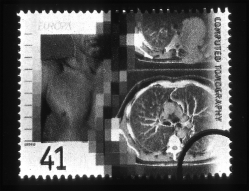 Figure 1.  A UK postage stamp of 1994, value 41p, showing CT scans.