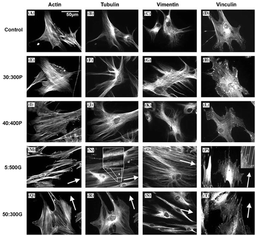 Figure 10. Fluorescence images of actin, tubulin and vimentin cytoskeletons and vinculin (focal adhesions) of HBMSCs cultured on control and test materials. Increased cytoskeleton organizations and numbers of focal adhesions were seen on the topographies compared to cells on planar control. (N) tubulin is seen condensing along grooves while in (P), adhesions are seen aligning to the grooves. Images reproduced with permission from [Citation54].