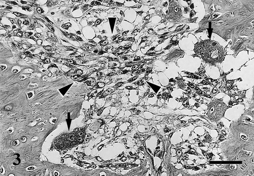 Fig. 3 Decalcified section of the tibiotarsus. Osteoclastic bone resorption on the surface of bone trabeculae (arrows) and proliferation of fibroblasts in the medullary cavity (arrowheads). HE. Bar=30 μm.