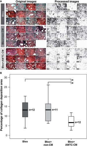 Figure 2. Digital image morphometric analysis of lung collagen deposition. (A) Microphotographs taken before (left panel) and after (right panel) the imaging analysis procedure used to quantitate the collagen staining (black areas) from the image. The identification number of each mouse is indicated on each microphotograph. (B) Median values with IQR of quantitative collagen deposition are represented as box-plots for Bleo (dark gray), Bleo + non-CM (light gray) and Bleo + AMTC-CM (white) groups. The number of mice in each group is indicated (n). Brackets represent significant differences between groups; *P < 0.05.