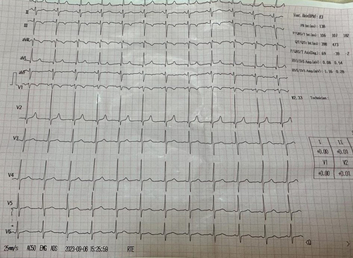 Figure 3 Electrocardiography (ECG) revealed sinus tachycardia.