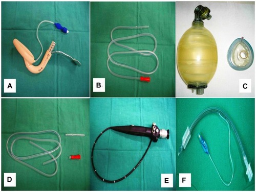 Figure 2 (A–C) Application of the Levin tube through the bronchoscope (steps). (D) Demonstration of the laryngeal mask with the bronchoscope and Levin tube. (E) Levin tube within the laryngeal steel handle mask. (F) Endotracheal tube with the Levin tube inserted as a guide.