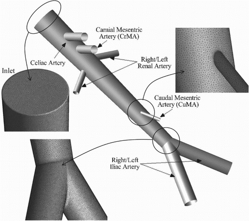 Figure 1. Human abdominal aorta domain and grid. Inset figure shows the mesh resolution at the inlet surface, and CuMA and iliac bifurcations.