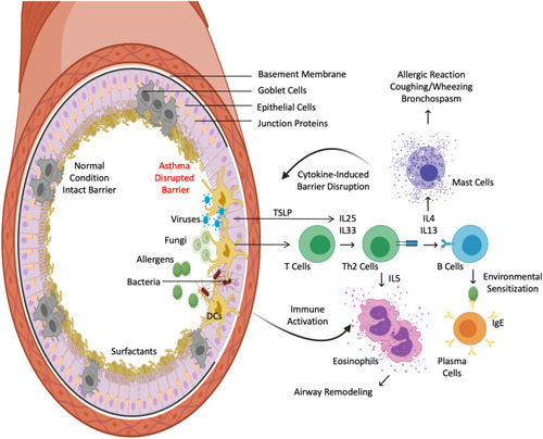 Figure 3 Immunity-microbiome crosstalks at respiratory tract. Airway epithelial barriers are protected by junctional structures and a family of surfactant proteins. Intact barriers and homeostatic interplay between commensals and innate immunity prevent the entrance of allergens and pathogens (left). In contrast, aberrant interaction between microbes, including viruses and fungi, with mucosal dendritic cells elicits an allergic inflammatory milieu that causes barrier dysfunction (right). This further allows translocation of inhaled allergens and pathogens, heightening Th2 inflammation. Microbes and TLSP from pathogen-activated epithelium primes mucosal dendritic cells to orchestrate T-cell production of Th2 cytokines, namely, IL-4, IL-5, and IL-13, via IL-25 and IL-33 signaling. IL-5 recruits eosinophils to the airway, while IL-4 and IL-13 activate B cells to develop into plasma cells that produce allergen-specific IgE and recruit mast cells to the tissues. These events ultimately perpetuate a vicious cycle of epithelial barrier dysfunction.