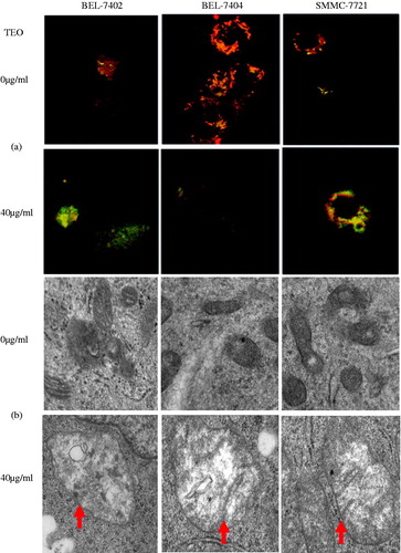 Figure 7. (a) MMP of HCC cell lines detected by JC-1 assay. The fluorescence images of JC-1 for cells (400×, final magnification). (b) TEM assay of structural damage (arrows) of mitochondria induced by TEO.