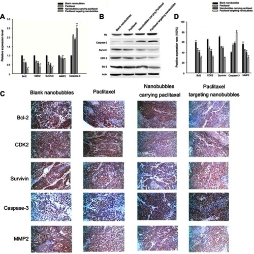 Figure 4 Determination of the molecular mechanism of paclitaxel targeting nanobubbles on SCLC. (A) qRT-PCR was used to evaluate the expression of Bcl-2, CDK2, survivin, MMP2 and caspase-3 in SCLC cells using 10 µM of drug in each group. (B) Western blot was applied to measure the expression of Rb, caspase-3, survivin, CDK2 and Bcl-2 in SCLC cells using 10 µM of drug in each group. (C, D) Immunohistochemical analysis was used to measure the expression of Bcl-2, CDK2, survivin, caspase-3, and MMP-2 in SCLC tumors. Drug was administered by tail vein injection at a dose of 1.32 mg/(kg body weight). *p<0.05, **p<0.01.