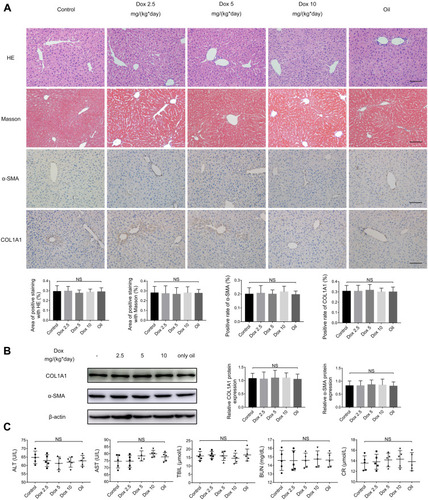 Figure 1 Doxazosin has no adverse effects on mouse liver function. (A) HE, Masson, and immunohistochemical staining of α-SMA and COL1A1 in liver tissues. Scale bar, 100 μm. (B) The α-SMA and COL1A1 protein expression levels in liver tissues were measured by immunoblotting. (C) The levels of alanine aminotransferase (ALT), aspartate aminotransferase (AST), total bilirubin (TBIL), blood urea nitrogen (BUN), and creatinine (CR) in the different treatment groups were determined.