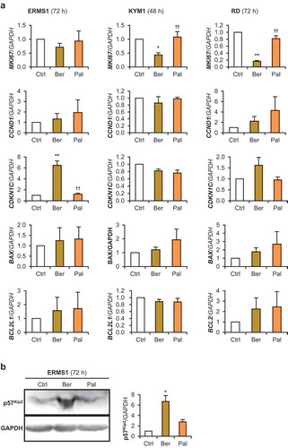 Figure 5.. Berberine inhibits cell cycle gene expression in RMS cells.(a) qPCR results of gene expression in RMS cells treated with 10 μM of berberine or palmatine for 48 h (KYM1) or 72 h (ERMS1 and RD). The mean value in control RMS cells was set at 1.0 for each gene. * p < 0.05 vs control, ** p < 0.01 vs control, †† p < 0.01 vs berberine (Scheffe’s F test). n = 3–5. (b) Representative images of Western blotting and the quantified p57Kip2 protein levels in the ERMS1 cells treated with 10 μM of berberine or palmatine for 72 h. * p < 0.05 vs control (Scheffe’s F test). n = 3.
