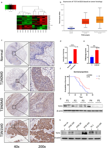 Figure 1. TCF3 is highly expressed in esophageal squamous cell carcinoma and correlates with patient prognosis. a. 6 pairs of esophageal squamous cell carcinoma tissue microarray shows that TCF3 is highly expressed in esophageal carcinoma compared to normal tissues and the expression increases with increasing malignancy. b. TCGA database shows that TCF3 expression in ESCC is highly expressed compared to other genes. c. Esophageal squamous cell carcinoma tissue microarray from 79 patients shows that TCF3 is highly expressed in ESCC tissues compared to normal tissues. d-e. The expression level of TCF3 is corresponding to ESCC progression. f. High TCF3 expression correlates with the prognosis of ESCC.g.TCF3 protein is highly expressed in ESCC tissues of five randomly selected patients. h. TCF3 is higher in ESCC cell lines especially in KYSE-150, TE1, and KYSE-410 than in normal esophageal epithelial cell line HET-1A.