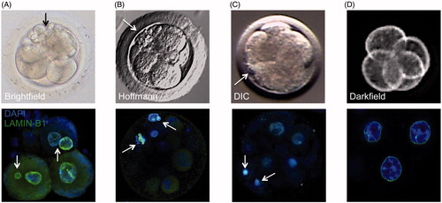 Figure 2. Correlation between cellular fragmentation and multi-/micronuclei formation in cleavage-stage embryos from different mammalian species. Top row: a representative photo of (A) human embryo taken by brightfield imaging, (B) rhesus macaque embryo using Hoffmann modulation contrast, (C) bovine embryo using differential interference contrast (DIC), and (D) mouse embryo taken by darkfield illumination time-lapse imaging. Note the appearance of several cellular fragments (black or white arrows) in cleavage-stage human and non-human primate embryos, but not in mouse embryos, with a lesser extent observed in bovine embryos. Bottom row: the incidence of cellular fragmentation is highly associated with mutli- and micronuclei formation as indicated by confocal microscopy of LAMIN-B1 (green) expression in DAPI-stained (blue) cleavage-stage embryos from the different mammalian species.