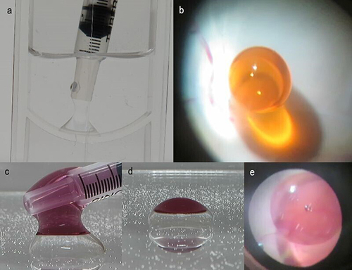 Figure 1 Creating each immiscible droplet. (a) Intentionally adhered SO on the bottom of the transparent container. Additional SO was carefully injected on the original SO application area. (b) The immiscible droplet consisted of PFCL and chili oil on the posterior retina of the vitrectomized pig eye. The PFCL layer was inconspicuous under the chili oil layer (Orange colored sphere). (c) Purple colored SO easily adhered to the PFCL bubble on the bottom of the transparent container. (d) The immiscible droplet consisted of PFCL and purple colored SO on the bottom of the transparent container. (e) The created immiscible droplet consisted of PFCL and purple colored SO on the posterior retina of the vitrectomized pig eye.