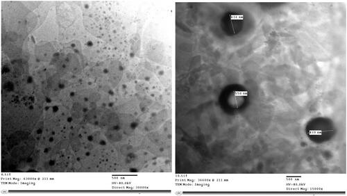 Figure 1. TEM micrograph of the optimized formula (F10).