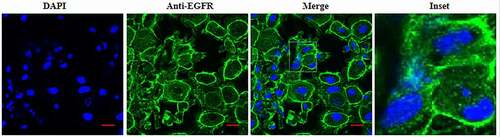 Figure 1. EGFR expression was detected by IFA.