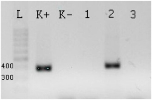 Figure 1. The PCR product of lktA F. necrophorum generated from field samples. L – Ladder 50 bp, K+ – positive control, K− – negative control with qH2O. Column 1–3 samples for F. necrophorum, column 1- the method of freezing and boiling from PBS is negative, lane 2 – the method of freezing and boiling from AB is positive, lane 3 – the method with high pure PCR template preparation kit is negative.