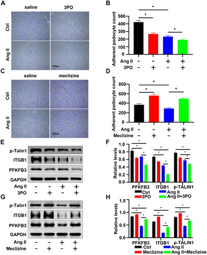 Figure 4. Regulation of podocyte adhesion was mediated by PFKFB3 in vitro. (A) Representative images of adhesion assays in different treatment groups of podocytes, Scale bars = 250 µm. (B) Quantitative determination of podocyte numbers in each group (n = 5), *p < 0.05. (C) Representative images of adhesion assays in different treatment groups of podocytes, Scale bars = 250 µm. (D) Quantitative determination of podocyte numbers in each group (n = 5), *p < 0.05. (E) Representative Western blots of phosphorylation of Talin1 and active ITGB1, and PFKFB3 in different treatment groups of podocytes. (F) Quantitative determination of Western blot of PFKFB3, ITGB1, p-Talin1 expression in each group (n = 3), *p < 0.05. (G) Representative Western blots of phosphorylation of Talin1 and active ITGB1, and PFKFB3 in different treatment groups of podocytes. (H) Quantitative determination of podocyte numbers in each group (n = 3), *p < 0.05.