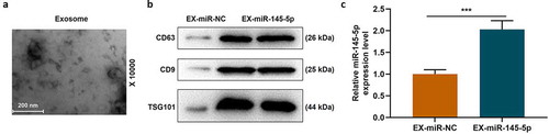 Figure 1. The identification of EXs around MSCs and the expression level of miR-145-5p were detected in MSC-EXs